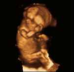 14 week sonogram