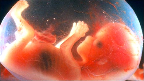 091013141130_466-262-unborn