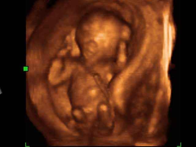 son_1sttri