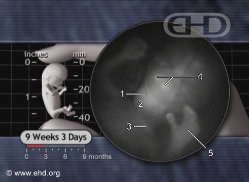 the-fetal-face-and-left-hand