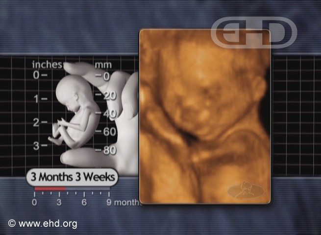 the-left-upper-limb-and-face