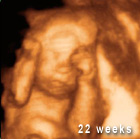 22-weeks