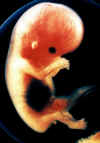 10_wk_fetus_small