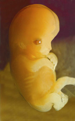 Seven-week-old unborn baby – most abortions happen around this time