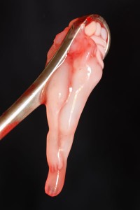 Part of an aborted baby at 8 weeks after conception. This is around the time most abortions are done. Is it moral to kill babies at this stage every day?