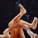 feet of unborn baby – first trimester