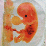 8 week old unborn baby