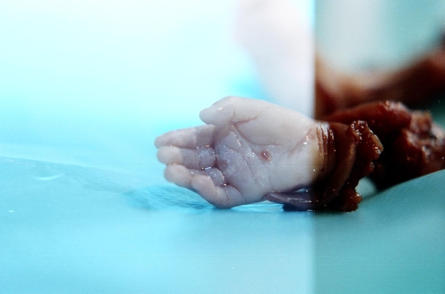 hand of baby aborted at seven months