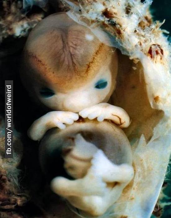 7 weeks – some clinics prescribe the abortion pill up to 9 weeks