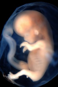 9 to 10-week-old unborn baby – almost half of all abortions happen at this time or later