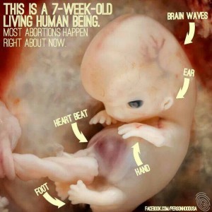 7 wk dia