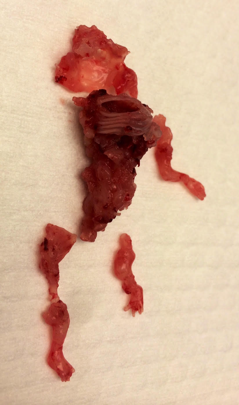 Images of aborted babies from pathology department - ClinicQuotes