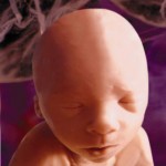 24 weeks. Babies around that age were killed by partial-birth abortion