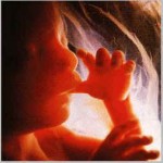 18 weeks. This is what her baby looked like before the abortion
