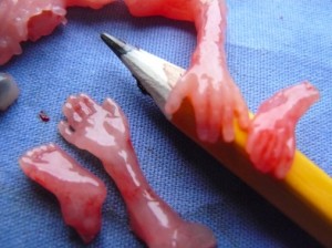 babies aborted at 10 weeks