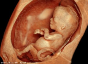 Preborn baby – first trimester. 