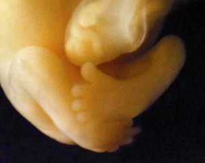 Feet of baby at 7 weeks