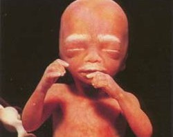 While president of feminist group praises the one child policy, Chinese woman undergoes five forced abortions